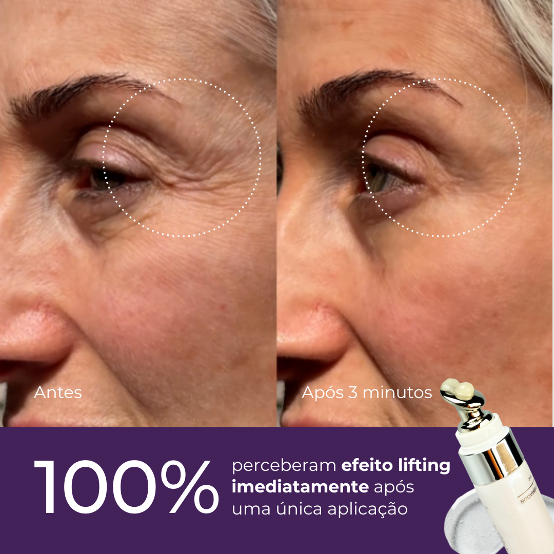 Sérum Redutor Instantâneo de Linhas Le Moritz