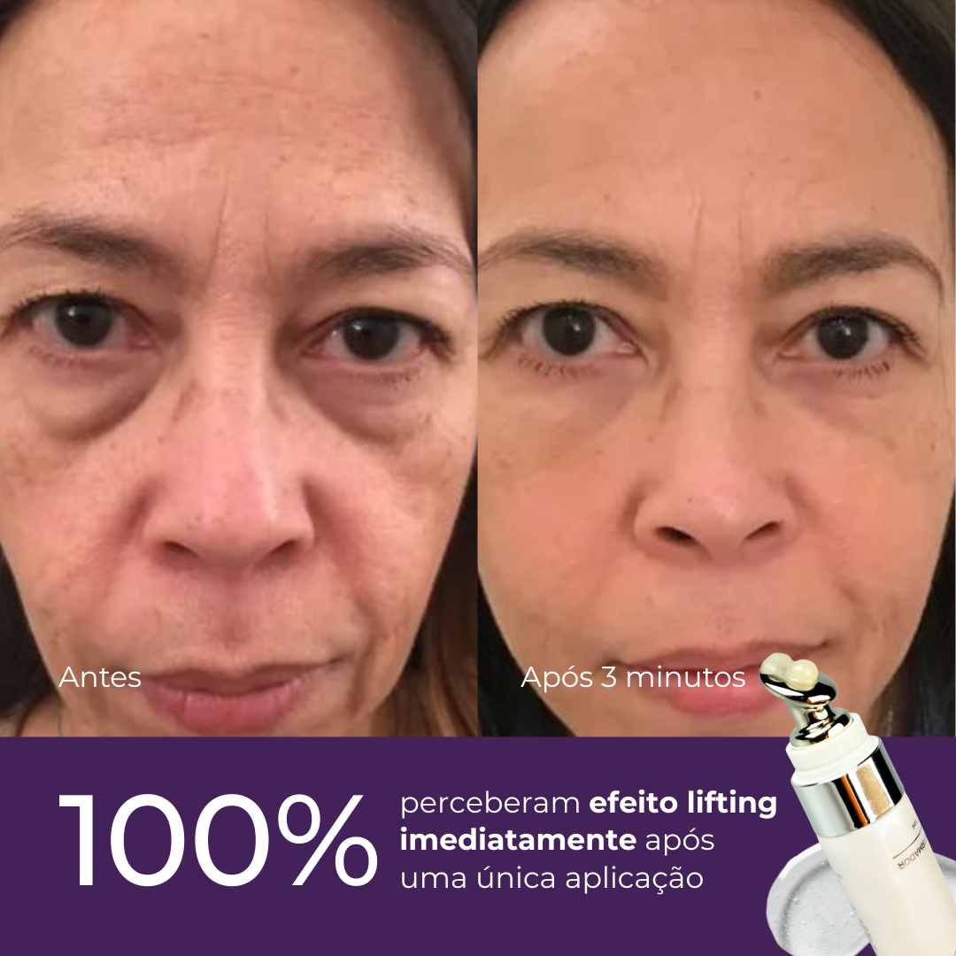 Kit Transformação Instantânea Le Moritz