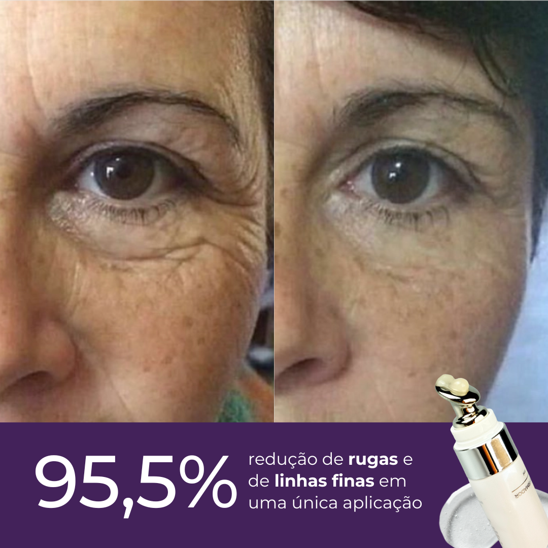 Protocolo de Rejuvenescimento Le Moritz