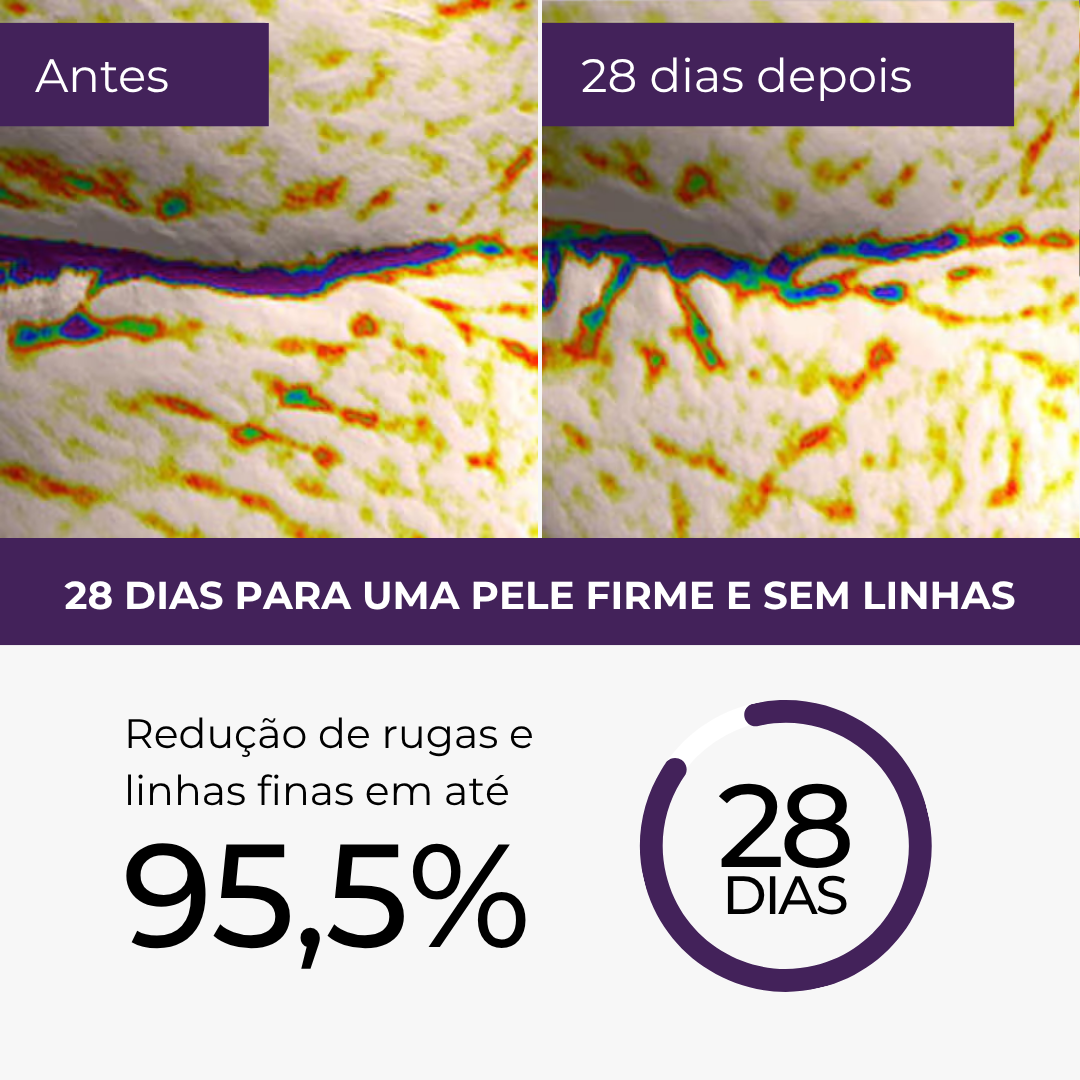 Protocolo de Rejuvenescimento Le Moritz