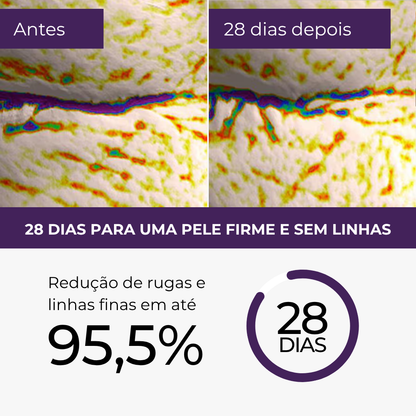 Protocolo de Rejuvenescimento Le Moritz