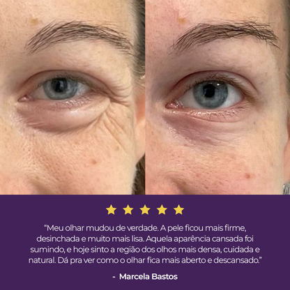 Kit Lifting e Firmeza para Olhos Le Moritz