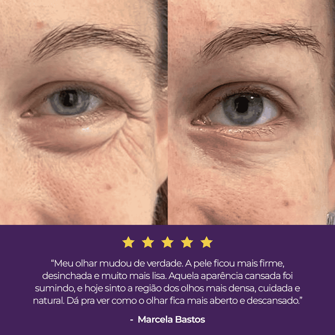 Sérum Revitalizador de Olhos Le Moritz