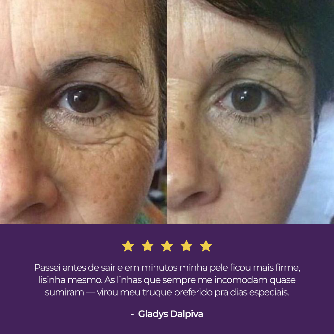 Sérum Redutor Instantâneo de Linhas Le Moritz