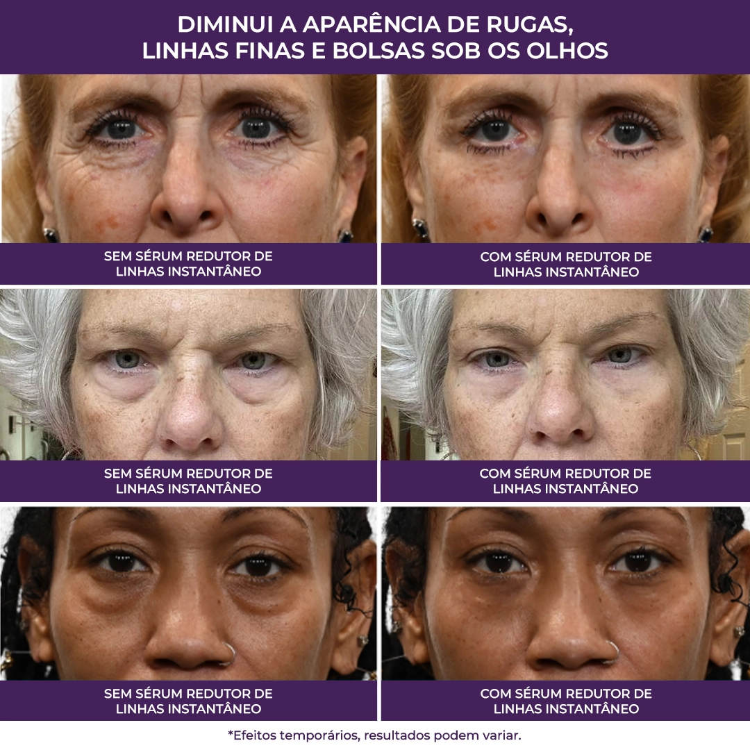 Sérum Redutor Instantâneo de Linhas Le Moritz
