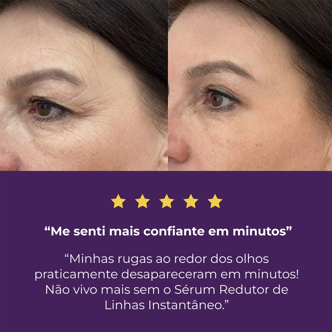 Sérum Redutor Instantâneo de Linhas Le Moritz