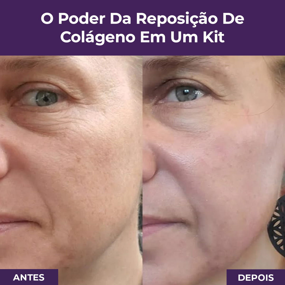 Kit reposição de colágeno Le Moritz