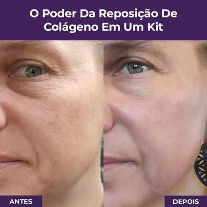 Kit reposição de colágeno Le Moritz