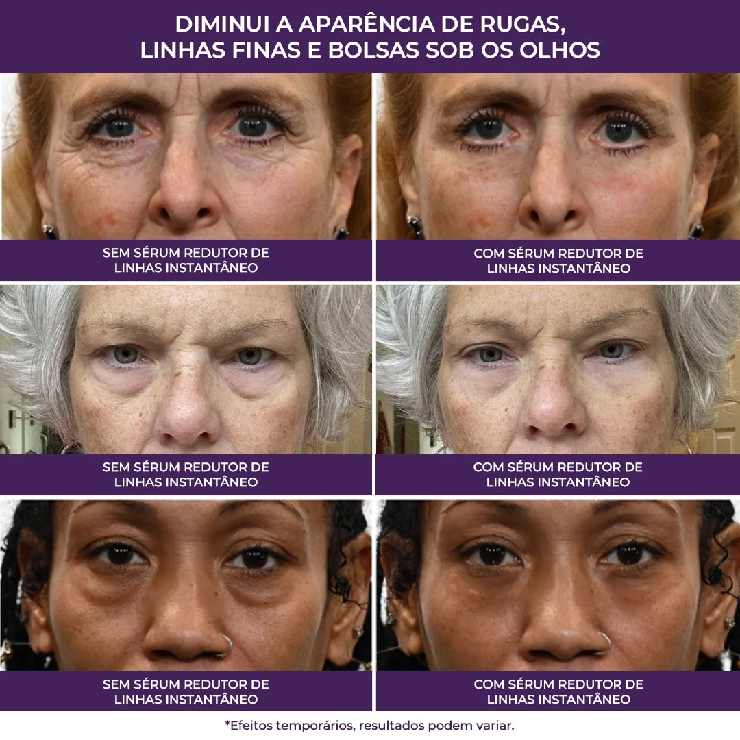 serum-carrossel-13